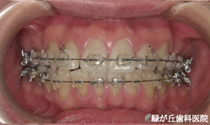 矯正歯科の詳細