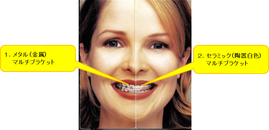 矯正歯科の詳細